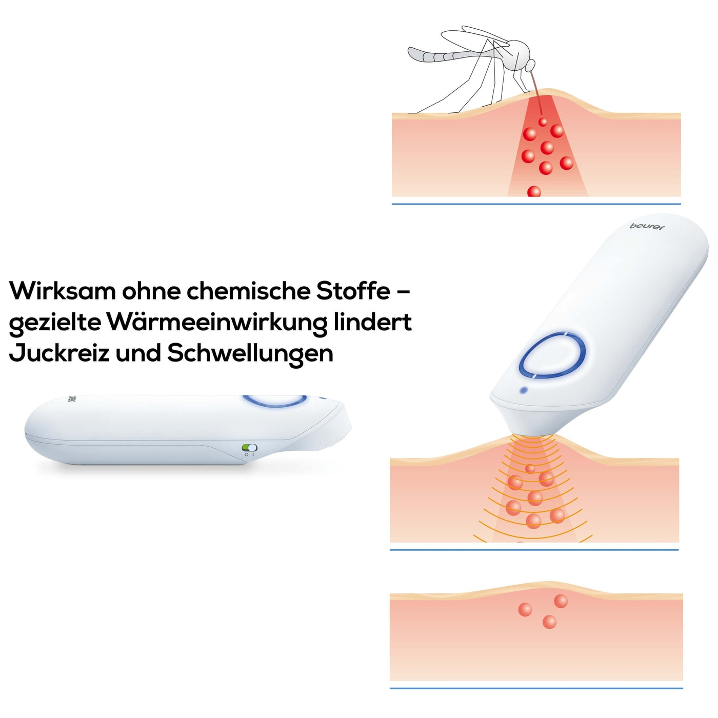 Beurer BR60 Insektenstichheiler